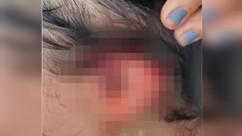 Mulher tem orelha cortada por companheiro no interior do Amazonas