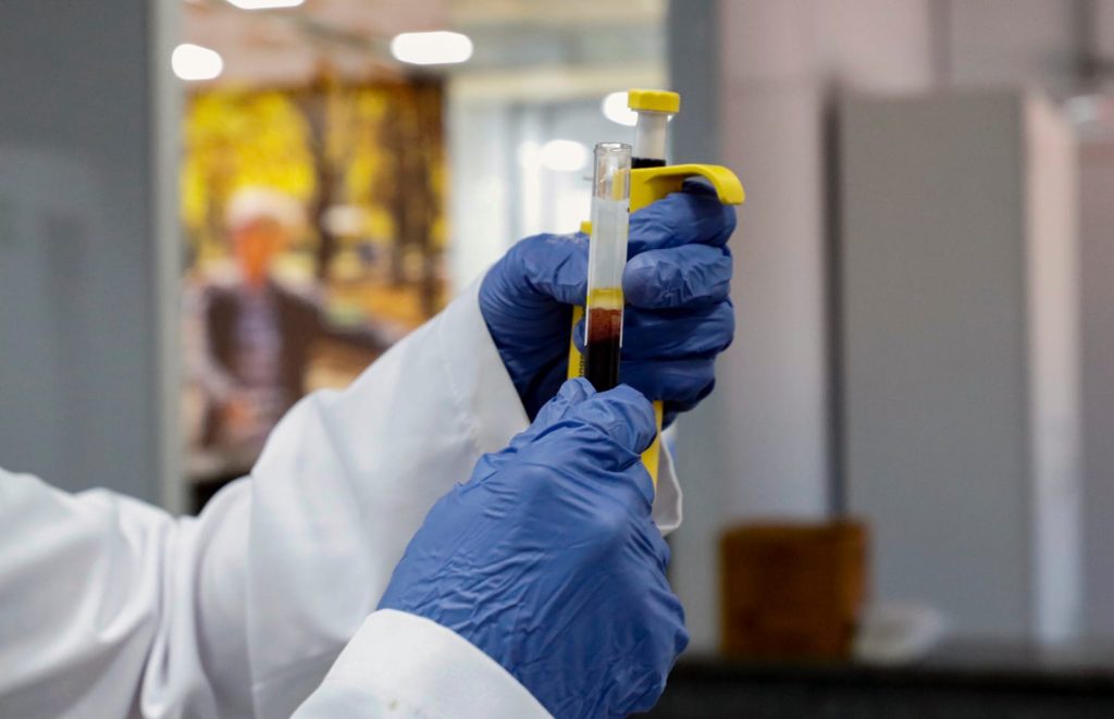 Óleos da Castanha do Brasil e do Açaí