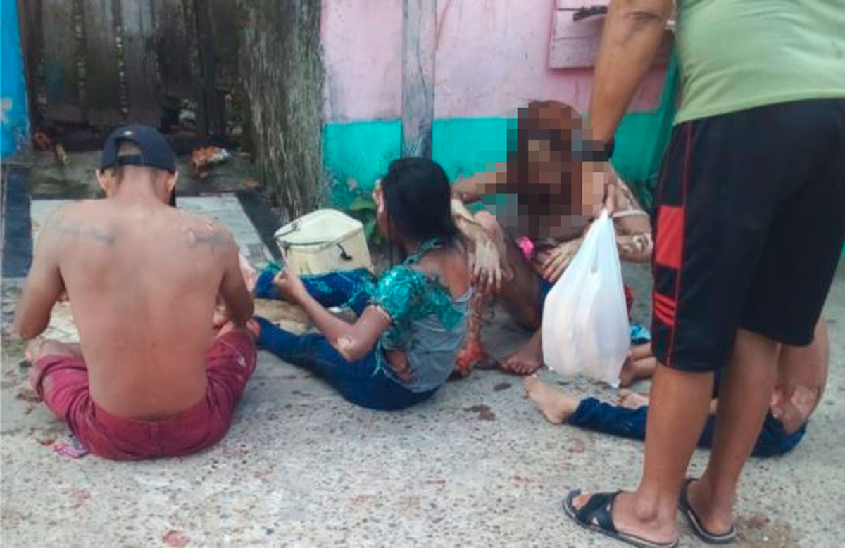 Incêndio em pousada deixa adultos e crianças com queimaduras graves em Jutaí