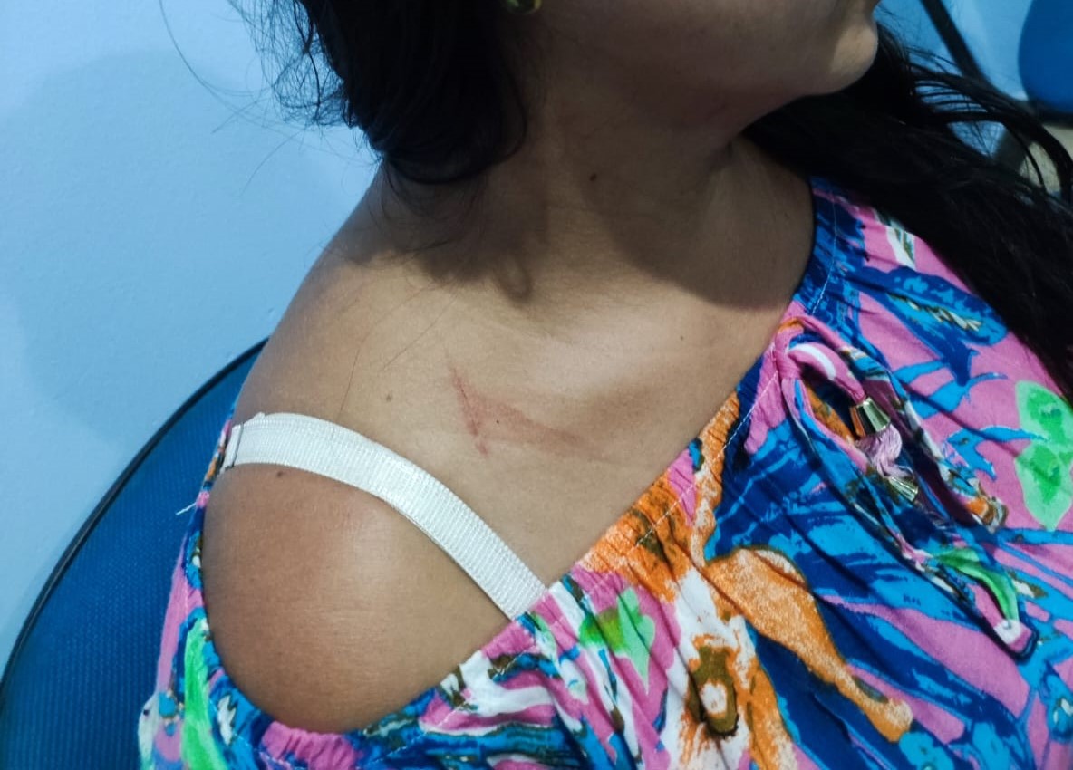 Mulher é vítima de cárcere privado e tentativa de feminicídio em Humaitá, no AM