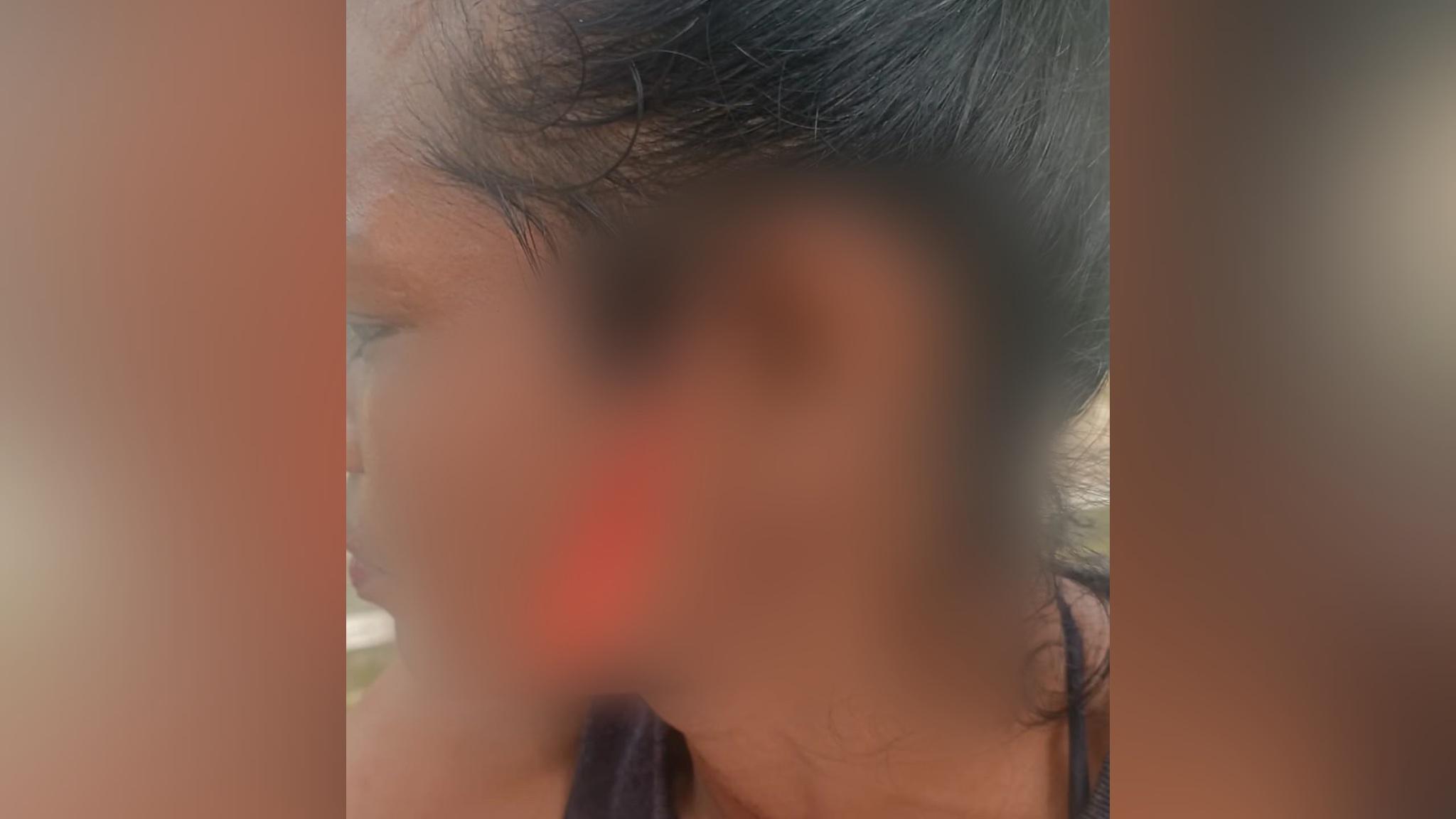 Mulher tem rosto cortado com estilete durante briga no Centro de Manaus