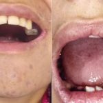 Entrada do CIIR, unidade onde jovem autista teve dentes extraídos sem autorização