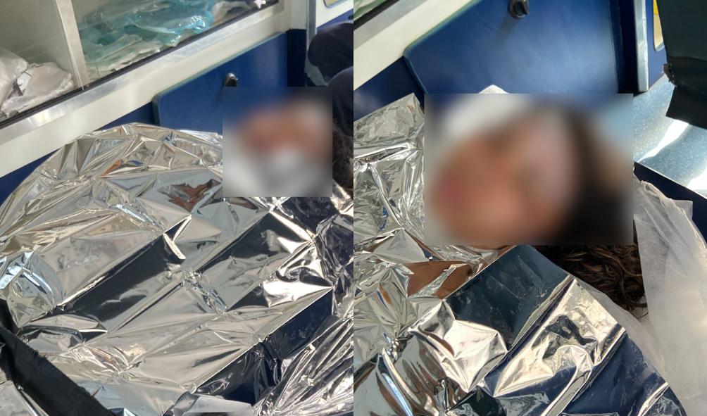 Grávida vítima de incêndio em fábrica de Manaus teve 44% do corpo queimado