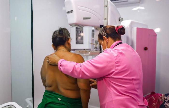 Manaus registra baixa procura de mulheres por exame de mamografia