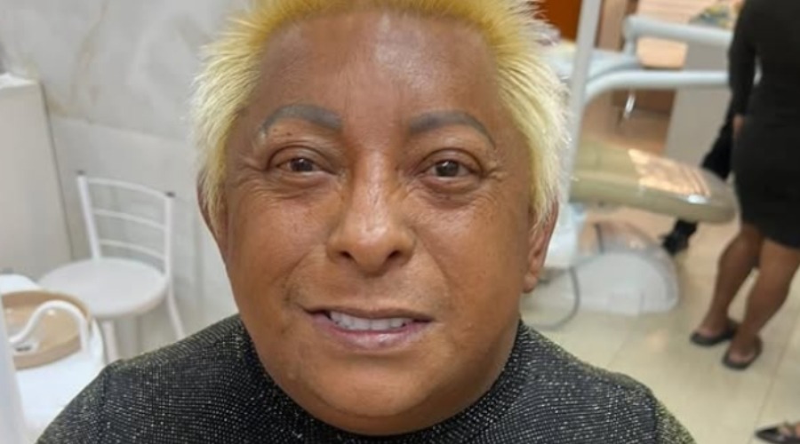 Patixa Teló faz implantes dentários e celebra nova fase: ‘Gratidão a Deus’