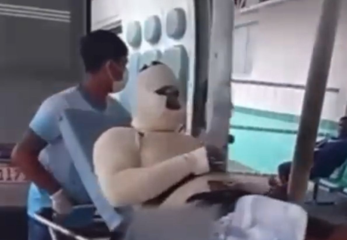 VÍDEO: Explosão em usina deixa trabalhador com queimaduras graves em Itacoatiara