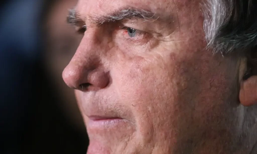 jair bolsonaro cirurgia-capa