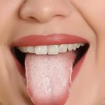 Você está com a língua branca? Do BBB ao Carnaval, Hapvida alerta sobre sinais da saúde bucal