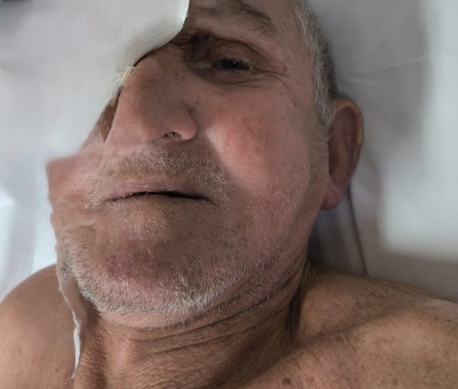 Hospital procura familiares de idoso internado após sofrer queda em Manaus