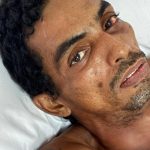 Hospital procura familiares de paciente internado após sofrer choque elétrico em Manaus