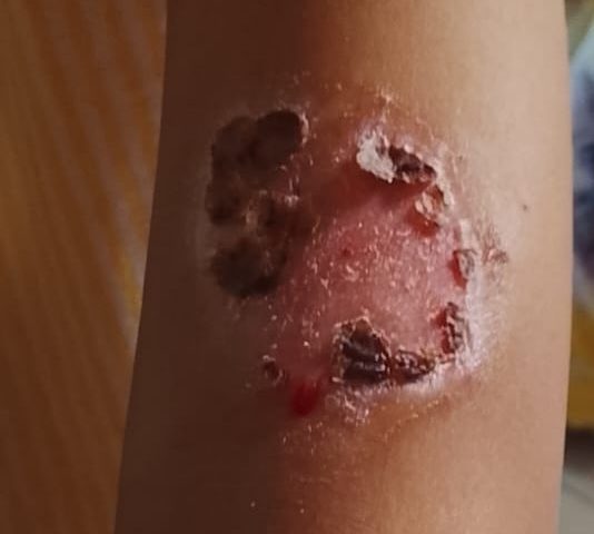 Pai é preso por torturar filhos de 3, 4 e 7 anos em Manaus