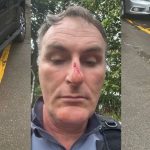 Tenente da PM diz ter sido agredido por policiais civis dentro da Delegacia Geral, em Manaus