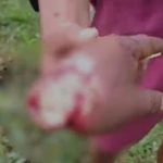 IMAGEM FORTE: Homem tem mão decepada a terçadadas durante briga por dinheiro em Manacapuru