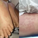 Criança é internada após suspeita de contaminação com detergente da Ypê