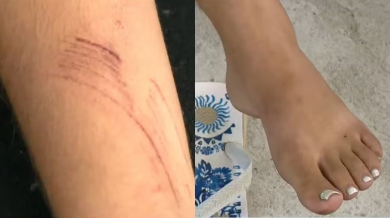 Mulher com marcas de violência no ES