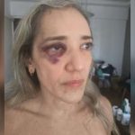 Passageira é agredida por motociclista de aplicativo após reclamar de capacete