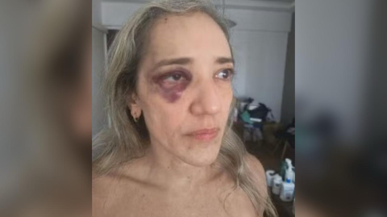 Passageira é agredida por motociclista de aplicativo após reclamar de capacete