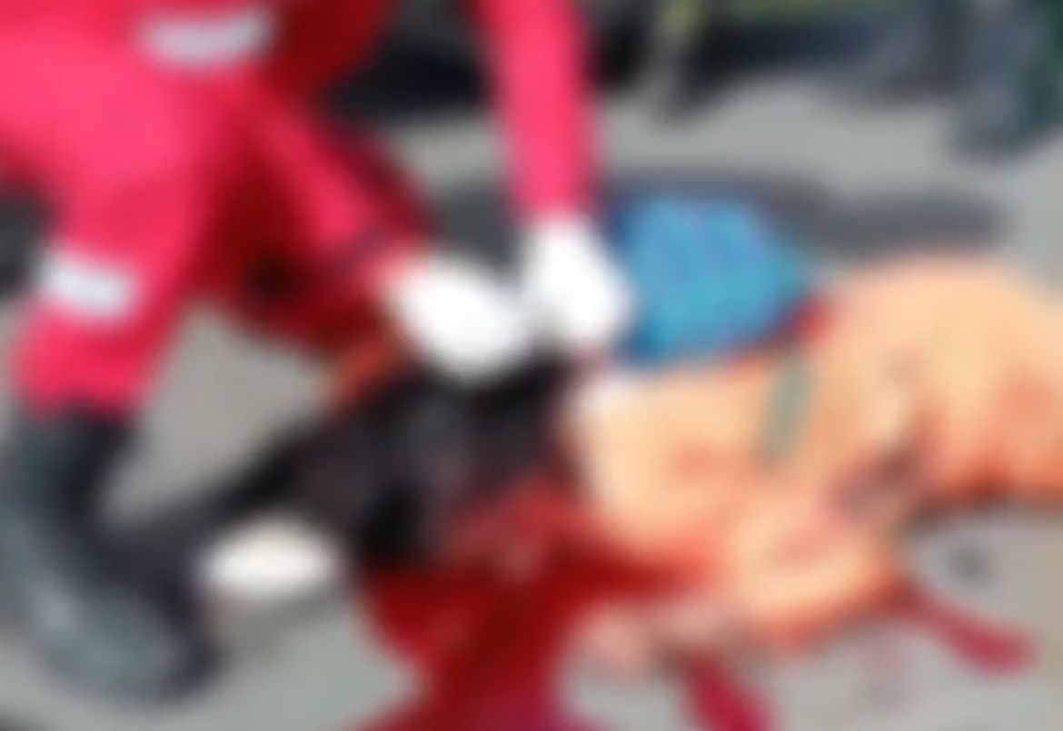 IMAGEM FORTE: Gari morre após ser atropelada por moto em Parintins