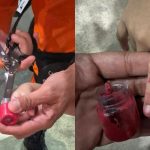 Criança fica com dedo preso em pote de massinha em Manaus