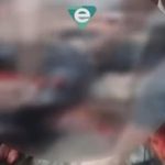 IMAGEM FORTE: Motociclista tem perna esmagada ao bater de frente com carro em Manaus