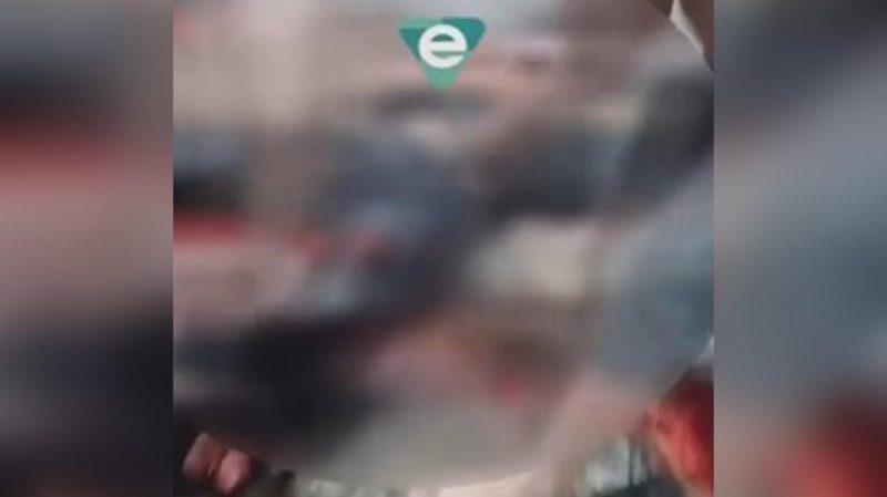 IMAGEM FORTE: Motociclista tem perna esmagada ao bater de frente com carro em Manaus