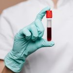 Doença falciforme afeta até 100 mil brasileiros e exige atenção