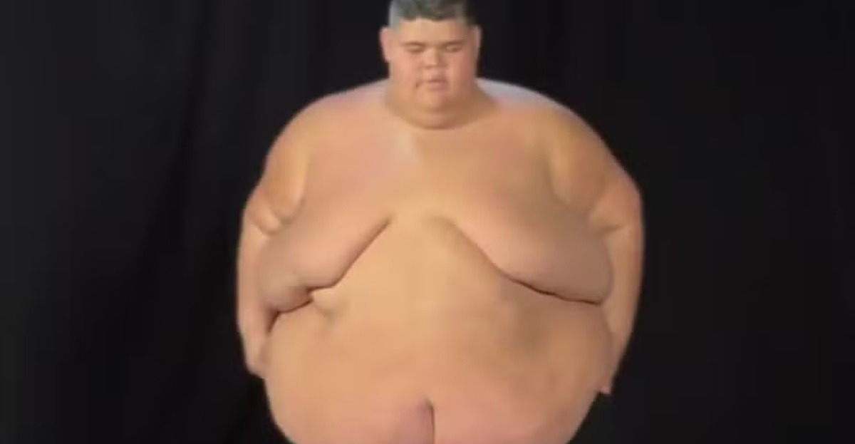 Gordão da XJ exibe antes e depois após sair de 350 kg para 220 kg; veja antes e depois