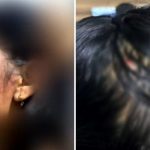 Mulher pula de moto para escapar de estupro após sofrer agressões em Goiás.
