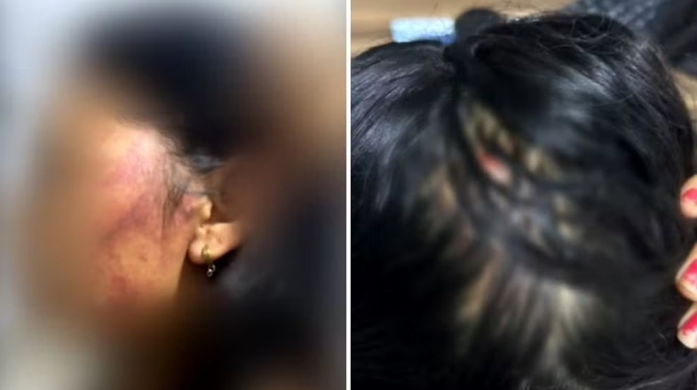 Mulher pula de moto para escapar de estupro após sofrer agressões em Goiás.