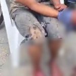 VÍDEO: Suspeito de assalto tem dedos decepados por justiceiros na Compensa