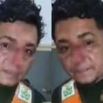 VÍDEO: mototaxista tem rosto cortado por linha de papagaio no AM