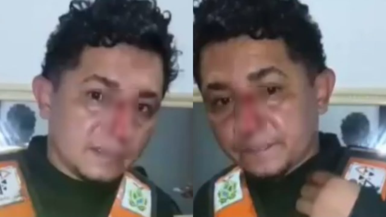 VÍDEO: mototaxista tem rosto cortado por linha de papagaio no AM