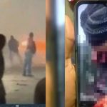 Veja fotos! Jovem tem rosto desfigurado após ser atingido por rojão em guerra de fogos
