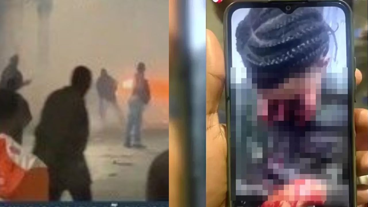 Veja fotos! Jovem tem rosto desfigurado após ser atingido por rojão em guerra de fogos