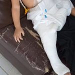 VÍDEOS: Mãe é denunciada após filha de 1 ano sofrer fratura na perna em Manaus