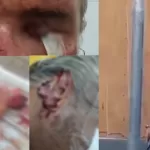 Idoso relata ‘ataque satânico’ de mulher trans após ser violentado e perder os dois olhos em Manaus